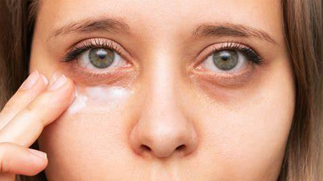 Cómo Eliminar las Ojeras